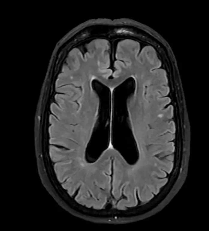 {attributes.image.alt ?? ''}