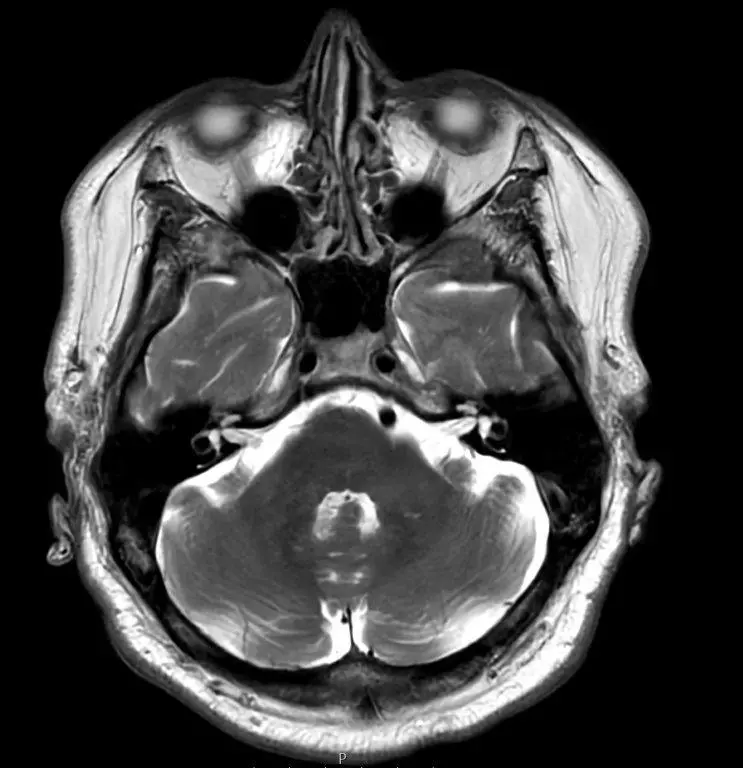 {attributes.image.alt ?? ''}