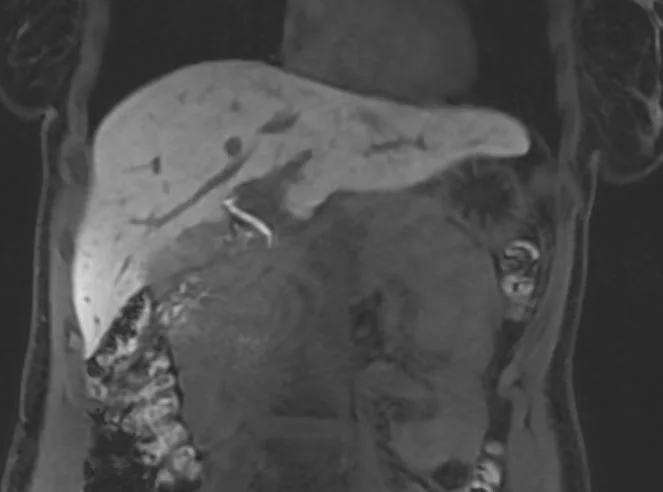 {attributes.image.alt ?? ''}