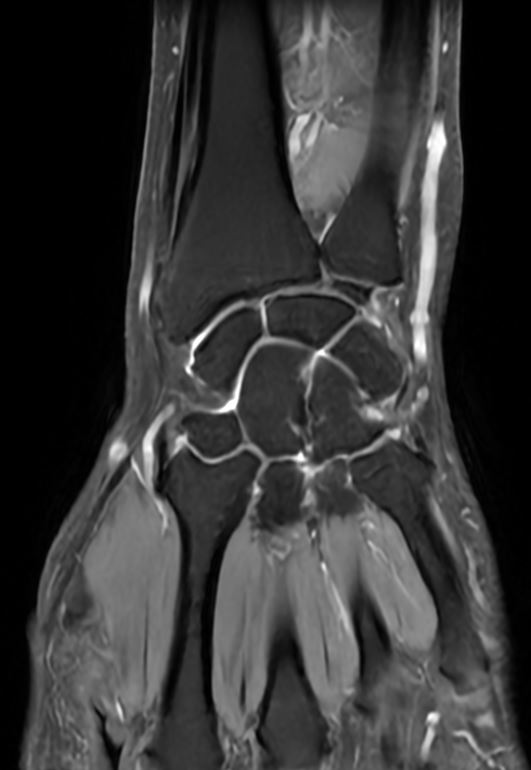 {attributes.image.alt ?? ''}