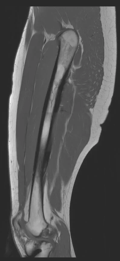 {attributes.image.alt ?? ''}