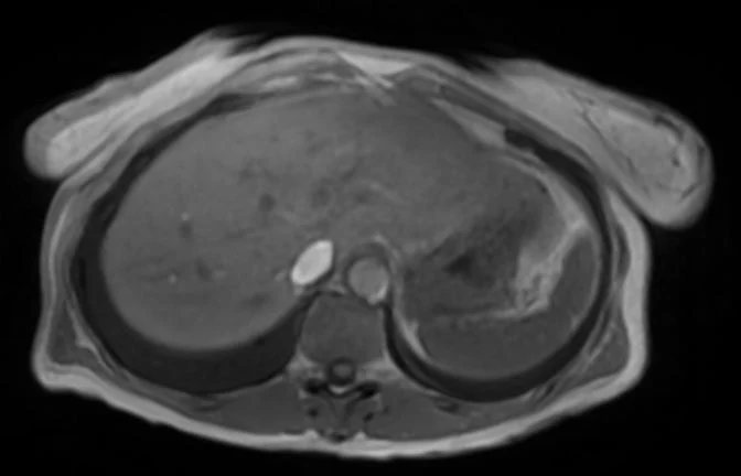 {attributes.image.alt ?? ''}