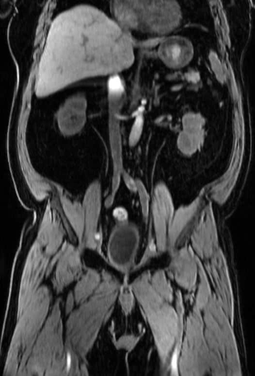 {attributes.image.alt ?? ''}