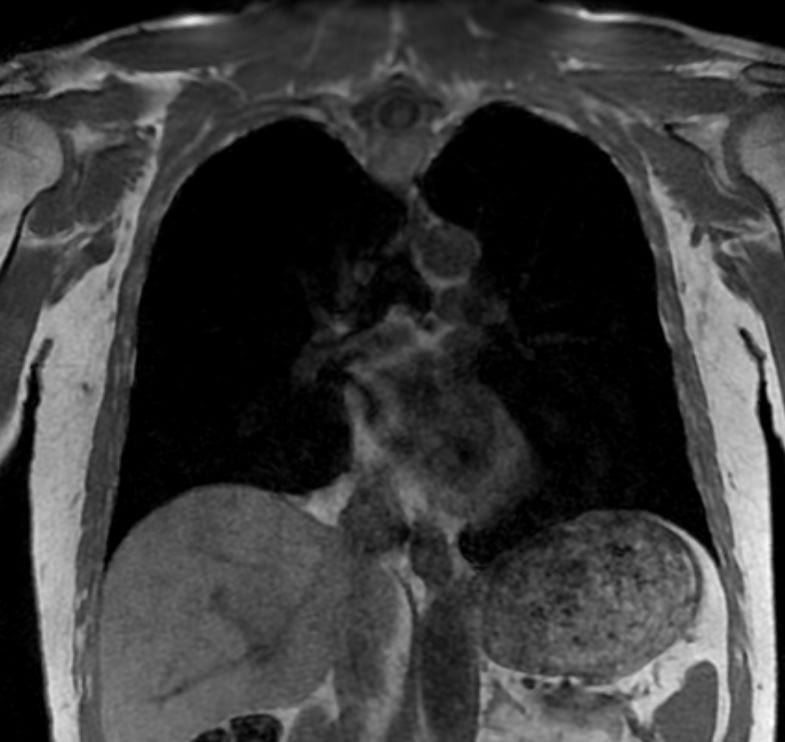 {attributes.image.alt ?? ''}