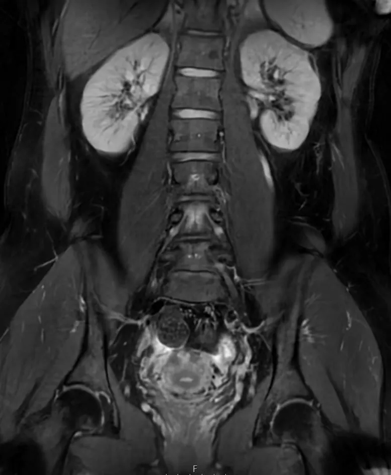 {attributes.image.alt ?? ''}