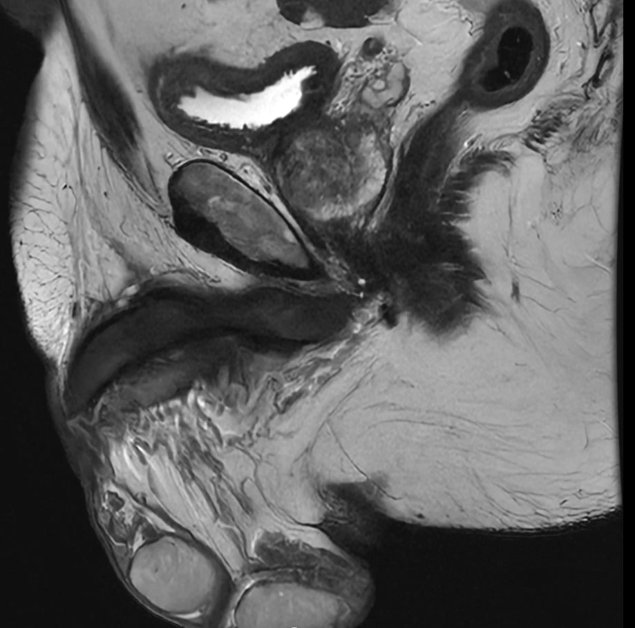 {attributes.image.alt ?? ''}