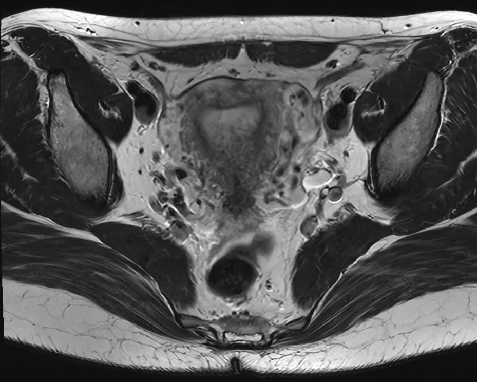 {attributes.image.alt ?? ''}