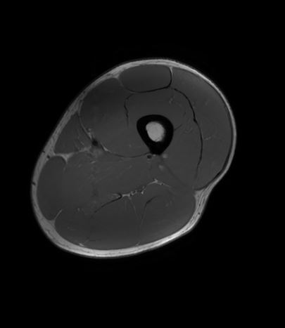 {attributes.image.alt ?? ''}