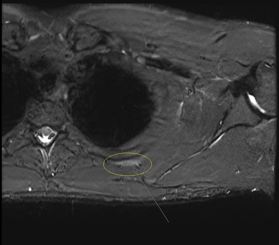 {attributes.image.alt ?? ''}