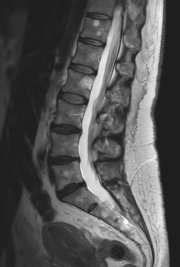 {attributes.image.alt ?? ''}