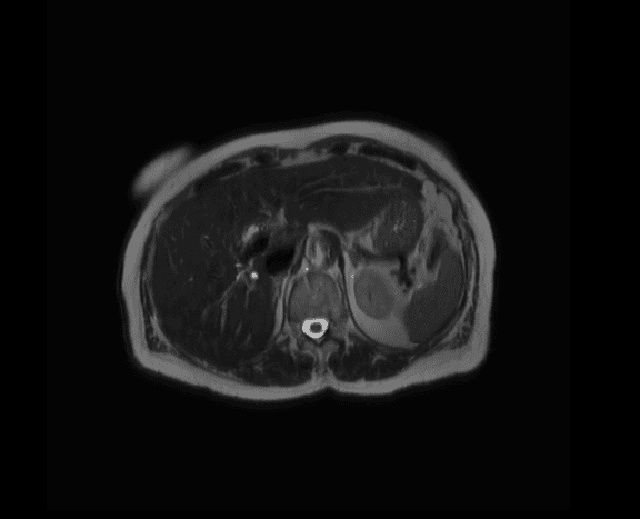 {attributes.image.alt ?? ''}