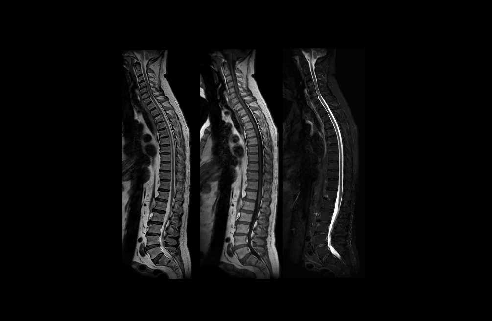 {attributes.image.alt ?? ''}