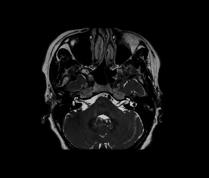 {attributes.image.alt ?? ''}